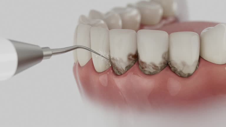 Trusted Dental Implants service in Thompson, ND - Dentist Open Now